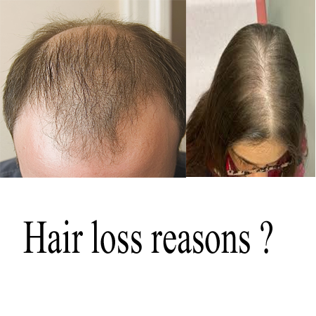 hair loss problems solutions